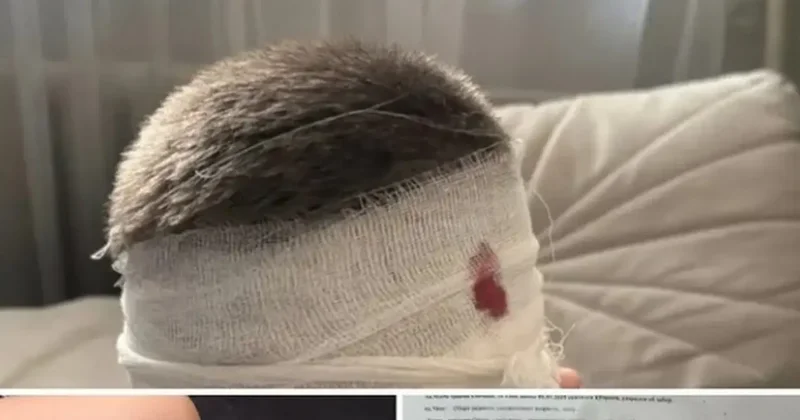 7 летний ребёнок получил серьёзные травмы, скатившись с горки в Павлодаре