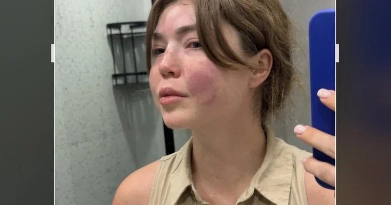 Я столкнулась со своим личным Бишимбаевым казахстанская актриса рассказала о домашнем насилии и сталкинге