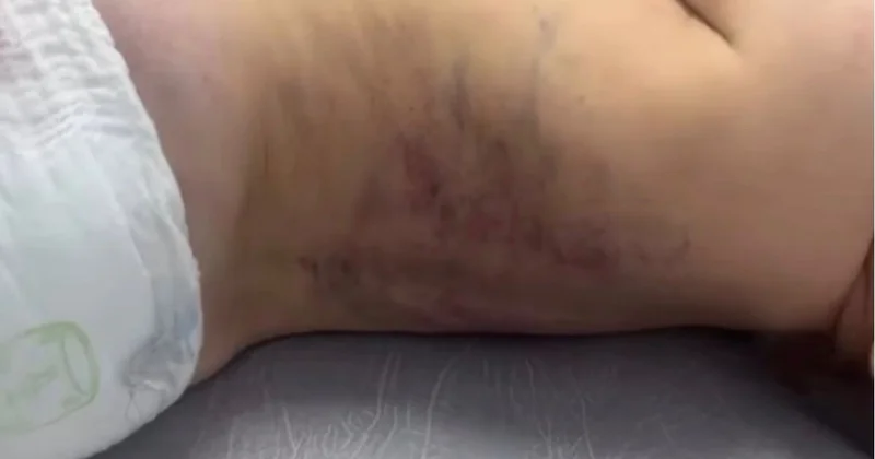 Жетісу облысында зорлық белгілері бар үш жасар бала ауруханаға жатқызылды