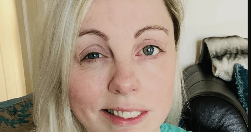 Женщина проснулась с перекошенным лицом накануне долгожданной свадьбы