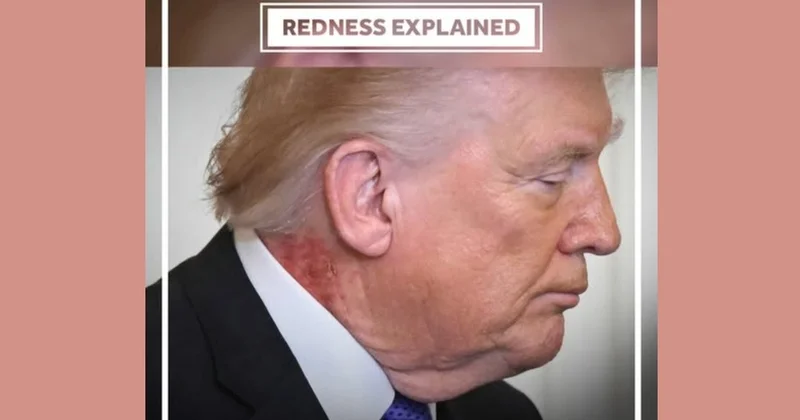 АҚШ президентінің мойын терісі қызарғаны байқалды