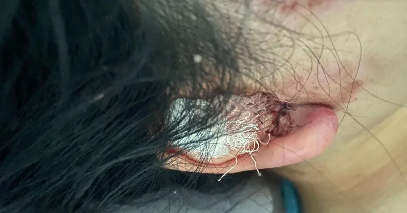 Жатырын да жыртып жіберген : Шымкентте өз үйінде зорланған қыз әділдікке жете алмай жүр