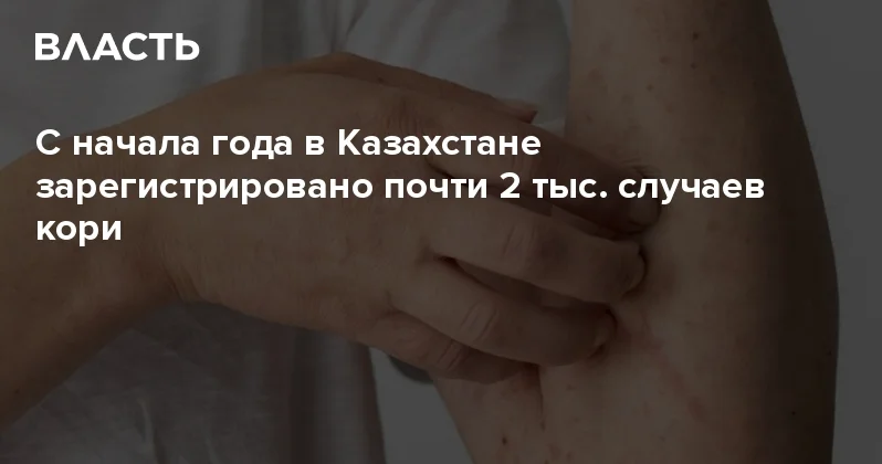 С начала года в Казахстане зарегистрировано почти 2 тыс. случаев кори Аналитический интернет журнал Власть