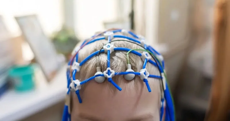 Әлемде 3 миллиардтан астам адам жүйке жүйесінің ауруларына шалдыққан