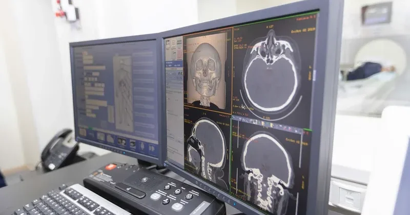 Қазақстанда сот медициналық сарапшыларға компьютерлік томография қолдануға рұқсат берілді