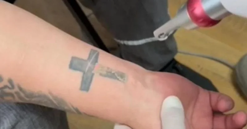 36 осужденных казахстанцев избавились от тюремных тату, чтобы порвать с прошлым