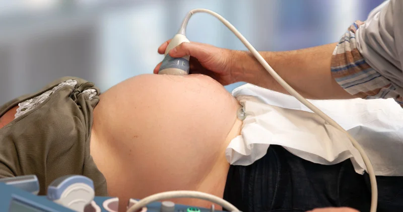 Астанада дәрігерлер 20 жастағы жас ананың жатырын алып тастаған: тергеу басталды