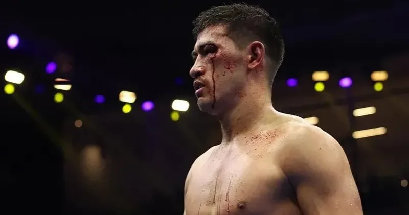 Дмитрий Биволдың көптен күткен жекпе жегі өтпей қалуы мүмкін