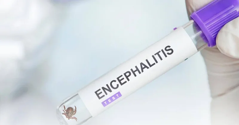 Кенеден қалай қорғануға болады маман кеңесі