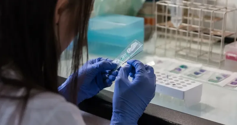 Алматы облысы әкімдігі Байсерке ауылындағы сібір жарасы жағдайына түсінік берді