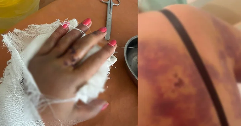 Лопата как орудие злобы: женщину жестоко избили в области Жетысу