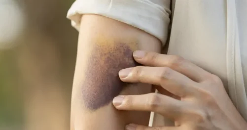 Местный житель избил женщину лопатой в Алматинской области