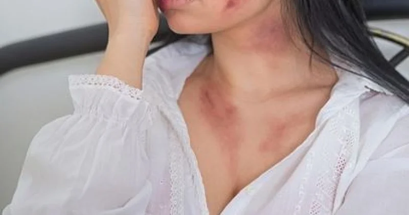 Женщину жестоко избили лопатой и сломали руки в Алматинской области