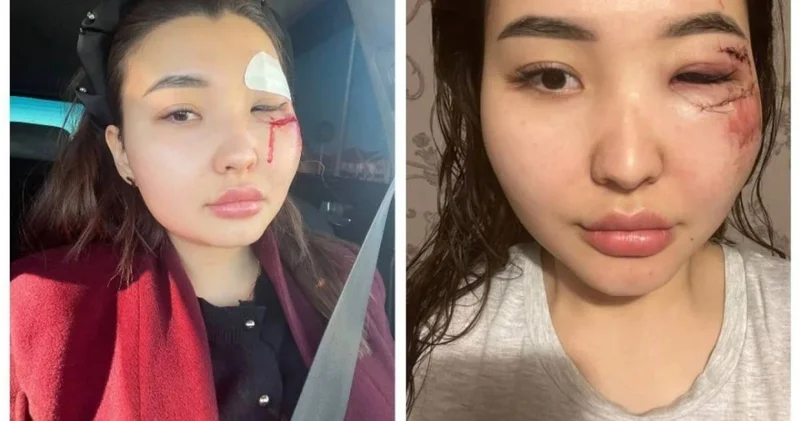 Зиратқа апарып, ұрып соққан : Атырауда блогер ісі бойынша сот басталды