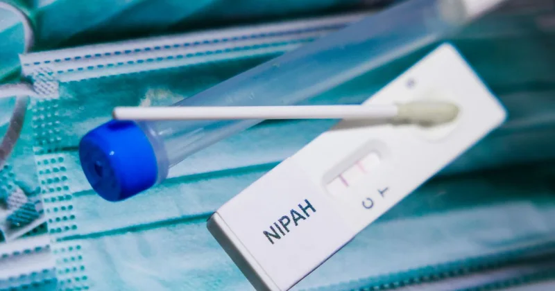 Кто больше всего подвержен риску заражения вирусом Нипах, рассказал эксперт
