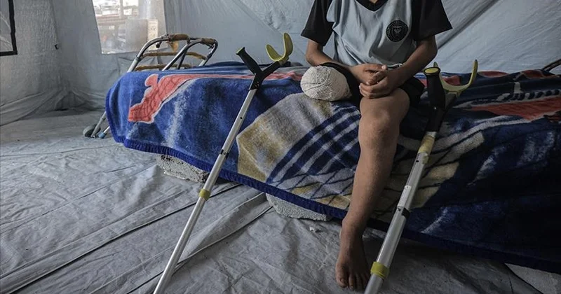 Газа: 6 мың адам ампутациядан кейінгі жедел оңалтуға мұқтаж