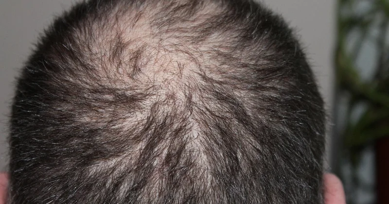 Женщина обвинила мужа в обмане и подала в суд из за лысины