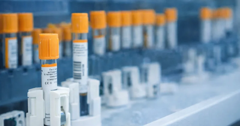 Сеть лабораторий INVIVO душила своих франчайзи