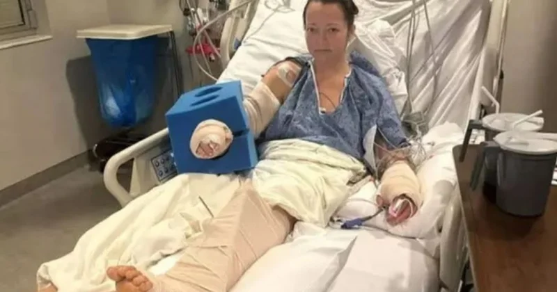 Женщина лишилась ноги после нападения питомца