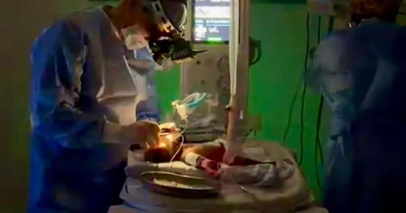 Шымкентте 650 грамм салмақпен туған нәрестенің көзіне күрделі ота жасалды