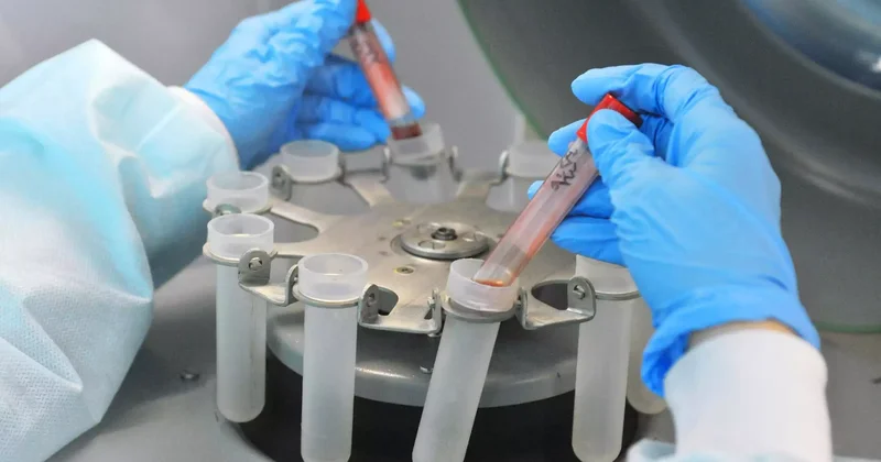 Маңғыстауда 44 адам ВИЧ жұқтырған: бесеуі бала