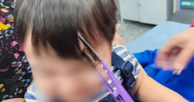 Мальчик пробил лоб ножницами при падении в Алматы