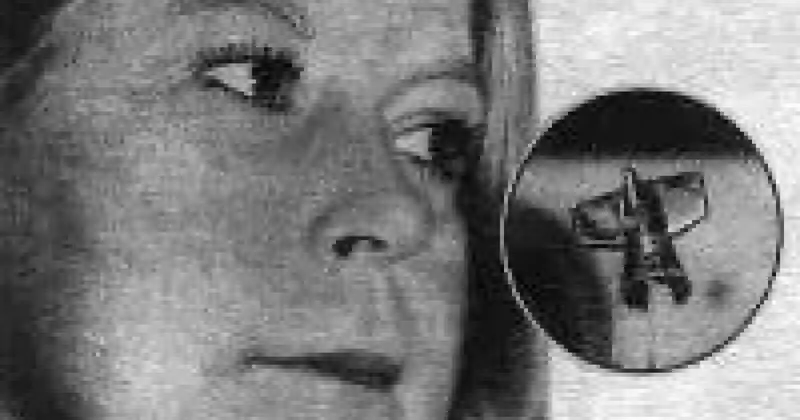 Ғаламшарлықтар орнатқан имплант