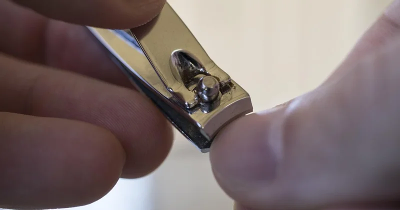 Что скрывается за ломкостью ногтей и как помочь