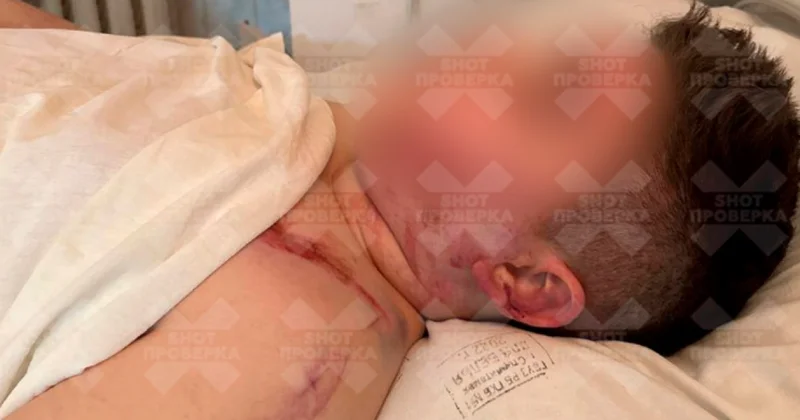 Ребенок лишился пальцев и получил перелом позвоночника на аттракционе в России