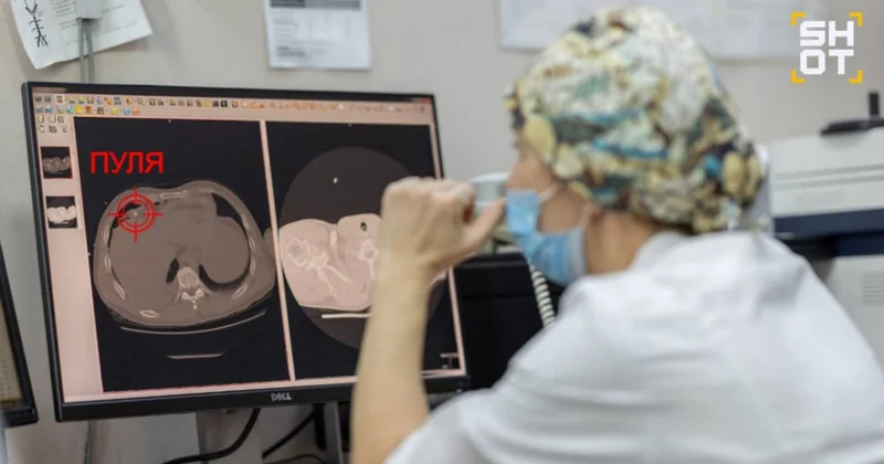 Мужчина воскрес после огнестрельного ранения в сердце в России