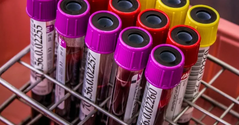 Прокуратура обнародовала результаты тестов знаменитостей Турции по делу о наркотиках