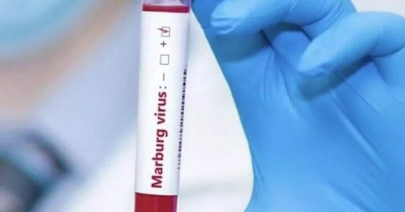 Өлім жітім 80% ға дейін: Африка елінде қауіпті вирус шықты