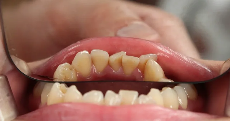 Ученые раскрыли простой способ профилактики 50 болезней