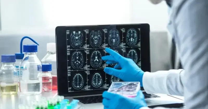 Анализ поставил под сомнение пользу новых препаратов от болезни Альцгеймера