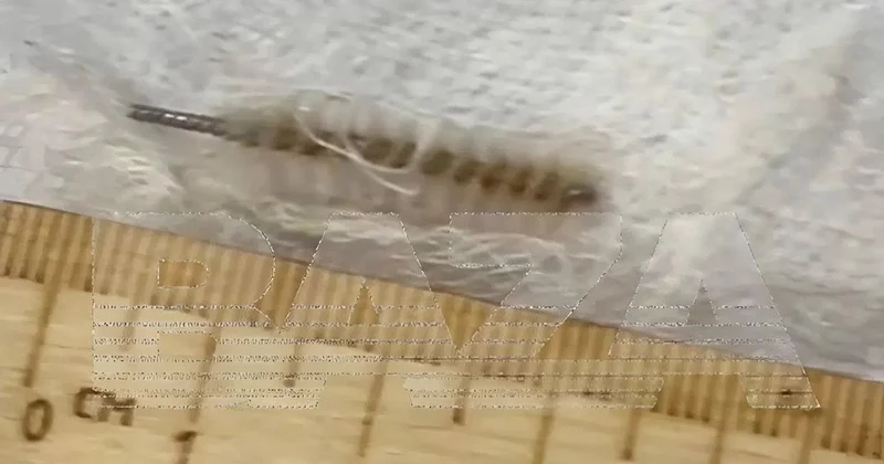 Забыли ершик в матке: гинеколог едва не погубила пациентку в России