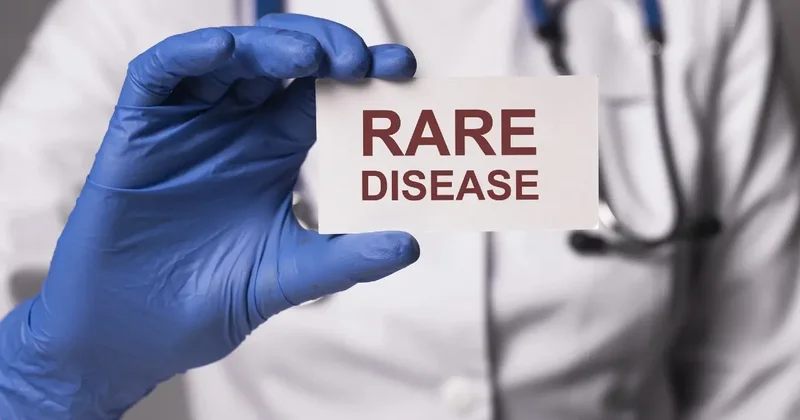Экономика редких диагнозов: о финансах, перебоях в поставке препаратов и праве на жизнь