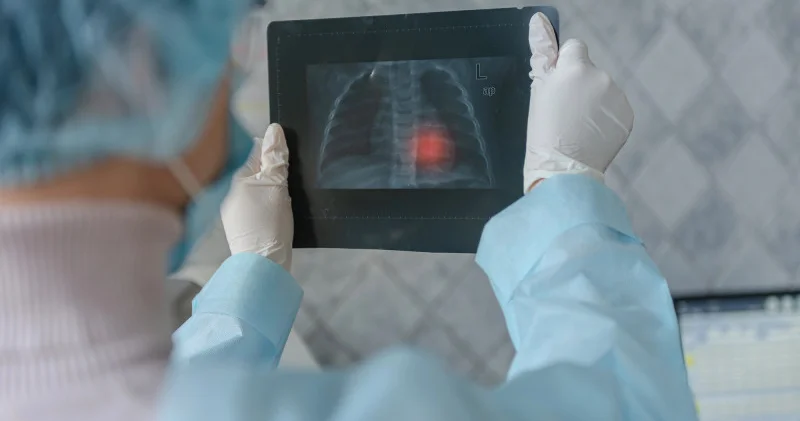 Астана мен Алматыдағы екі университет студенттерінен туберкулез анықталды