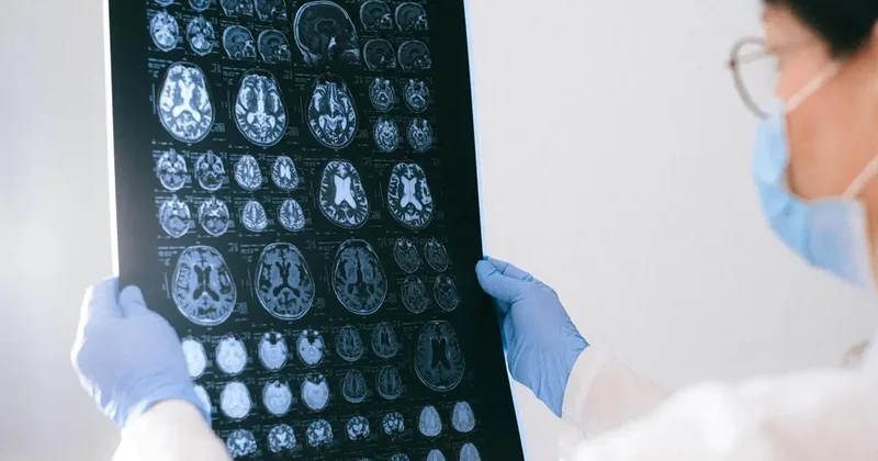 Жапония Паркинсон ауруын емдеу үшін iPS жасушаларына негізделген емдеуді мақұлдаған алғашқы ел