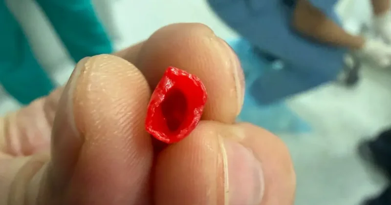 Врачи извлекли из бронхов ребенка колпачок от ручки в Актау