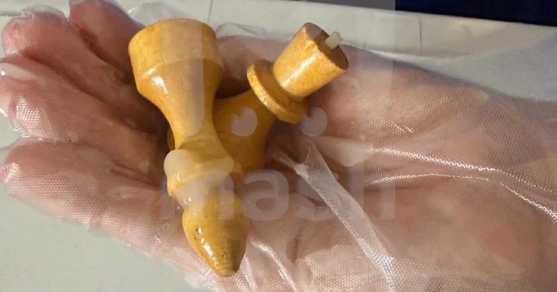 Две шахматные фигуры извлекли хирурги из прямой кишки мужчины