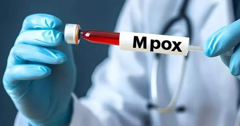 Елде маймыл шешегі ауруы тіркелген жоқ ДСМ