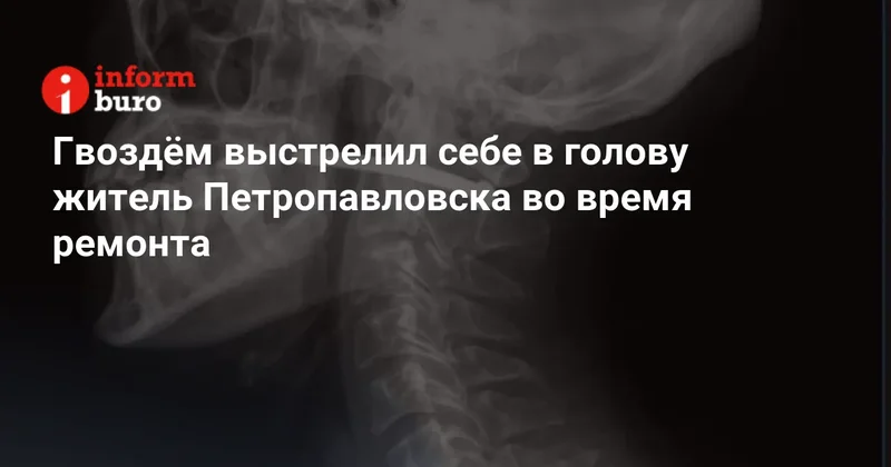 Гвоздём выстрелил себе в голову житель Петропавловска во время ремонта