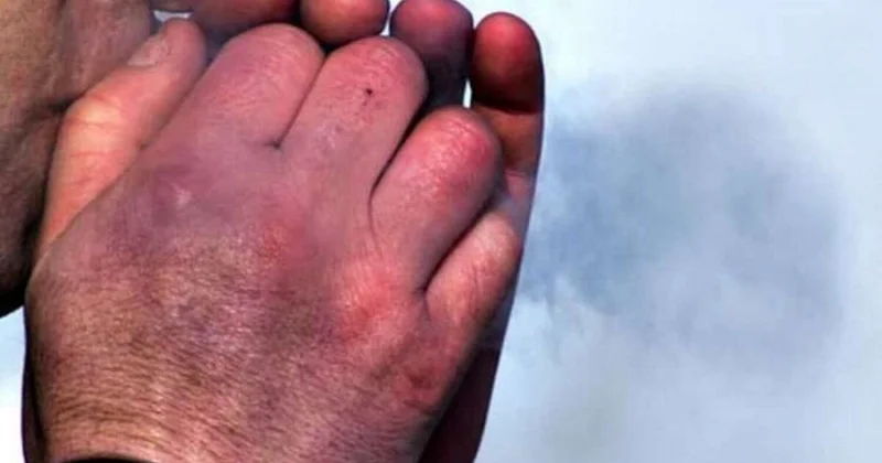 Қостанайда жыл басынан бері 20 адамды үсік шалған