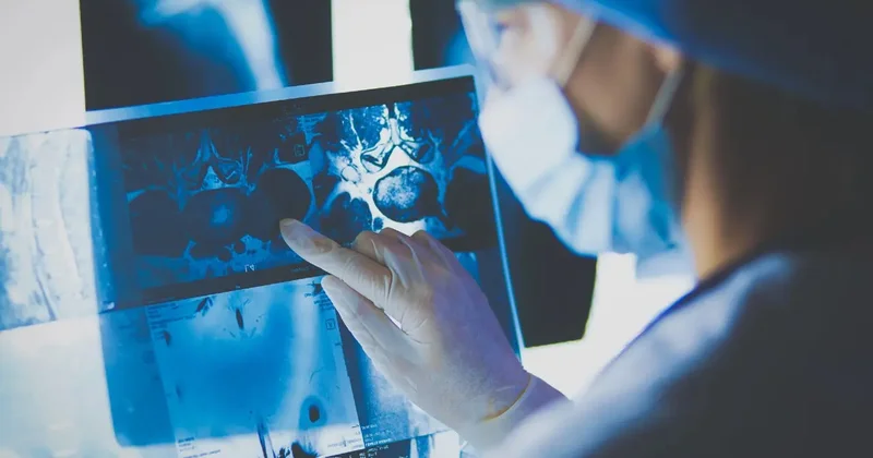 Ғалымдар аса қауіпті ми ісігін емдеудің қарапайым жолын тапты