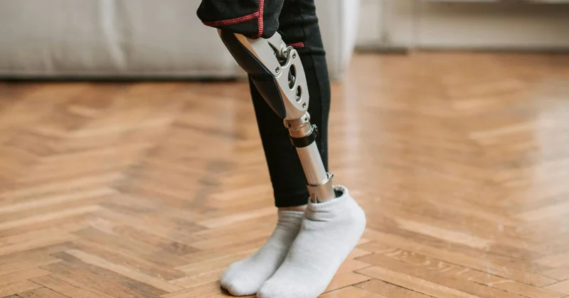 Жительнице Шымкента выплатят 2 млн тенге из за протеза