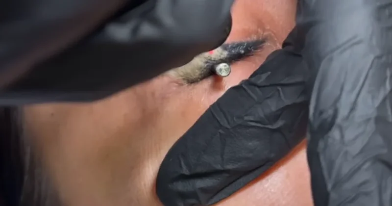 Казахстанке удалили татуаж стрелок с глаз: болезненная процедура вызвала споры в Сети