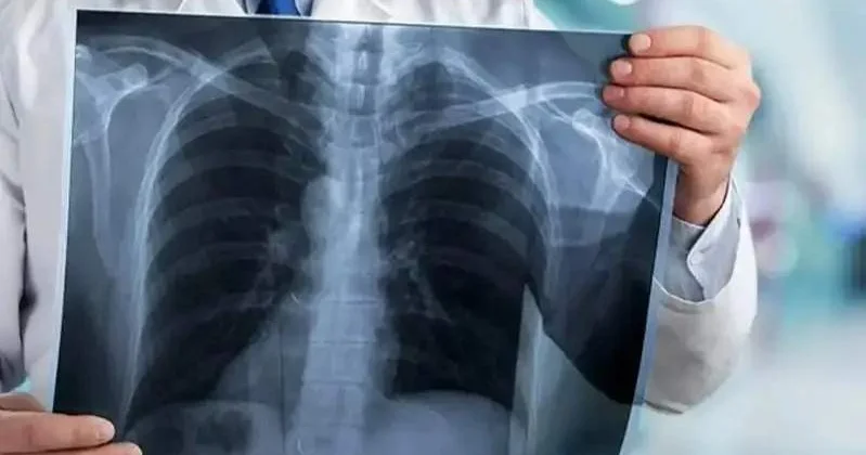 Қостанай облысы мектебіндегі туберкулез: тексеру қорытындысы шықты