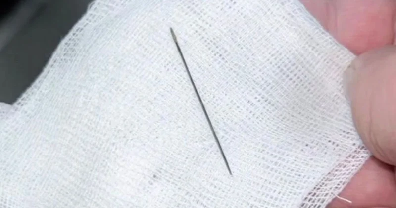 Иглу из тела восьмимесячного ребенка извлекли врачи в Туркестанской области (видео)