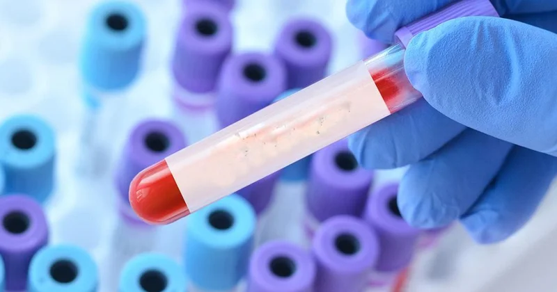 COVID 19 дың жаңа Стратус түрі көрші елде таралып жатыр