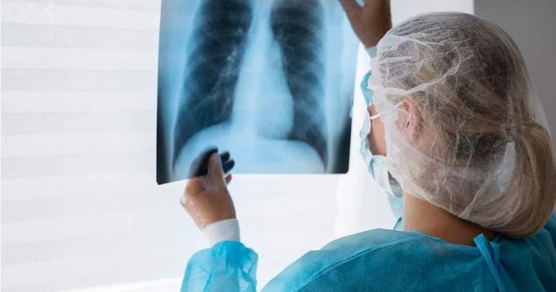 Қазақстанда туберкулезбен сырқаттанушылық 13% ға, өлім жітім 25% ға төмендеді